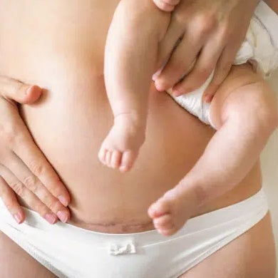 Culottes post-partum