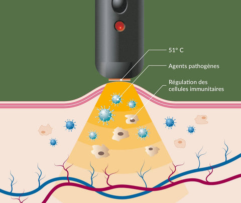 Stick chauffant contre les boutons de fièvre et l’herpès – Soulagement rapide, naturel et ciblé